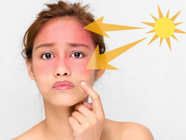 Tác hại của tia UV đối với làn da là rất nghiêm trọng