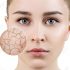 Kem dưỡng ẩm Bioderma tốt không? Top 3 sản phẩm bán chạy nhất