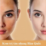 TOP 7 kem trị tàn nhang Hàn Quốc tốt nhất hiện nay