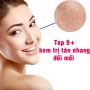 Review top 9+ loại kem trị tàn nhang đồi mồi bán chạy nhất