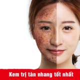 TOP 17 kem trị tàn nhang tốt nhất được bác sĩ da liễu khuyên dùng
